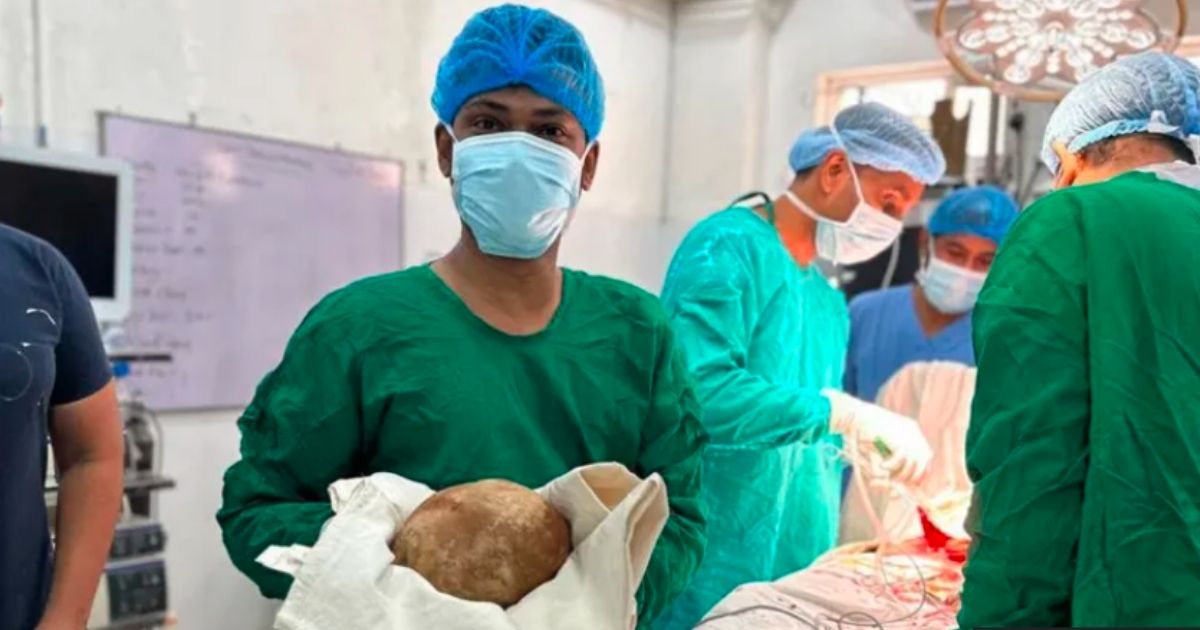 Rekord? Dokters verwyder blaassteen van 3,1 kg